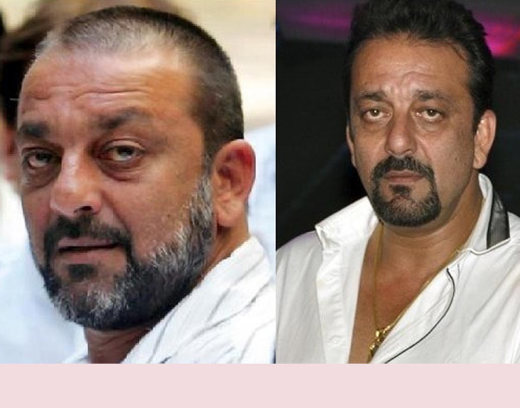 সঞ্জয় দত্ত: মাথার ফাঁকা অংশ ঢাকতে হেয়ার ট্রান্সপ্ল্যান্ট করিয়েছিলেন সঞ্জুও। তবে লুকস নিয়ে নানা রকম পরীক্ষা নিরীক্ষা করেছেন তিনি।