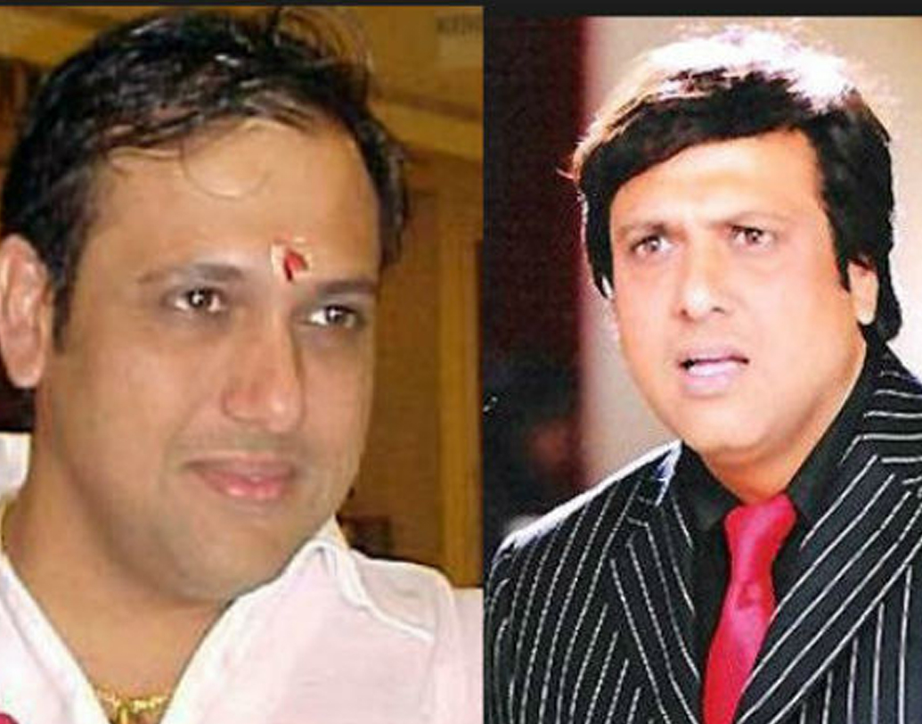 গোবিন্দা: বয়সের সঙ্গে সঙ্গে পাতলা হয়ে আসছিল চুল। তখনই নাকি হেয়ার ট্রান্সপ্ল্যান্ট করে নেন তিনি।