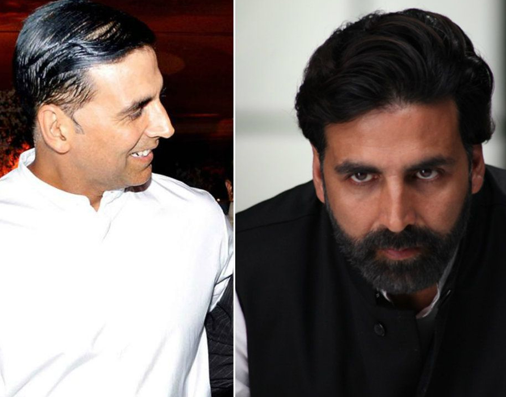 অক্ষয় কুমার: আক্কিও হেয়ার ট্রান্সপ্ল্যান্ট করিয়েছিলেন। টিনসেল টাউনে গুজব ছিল এমনটাই।