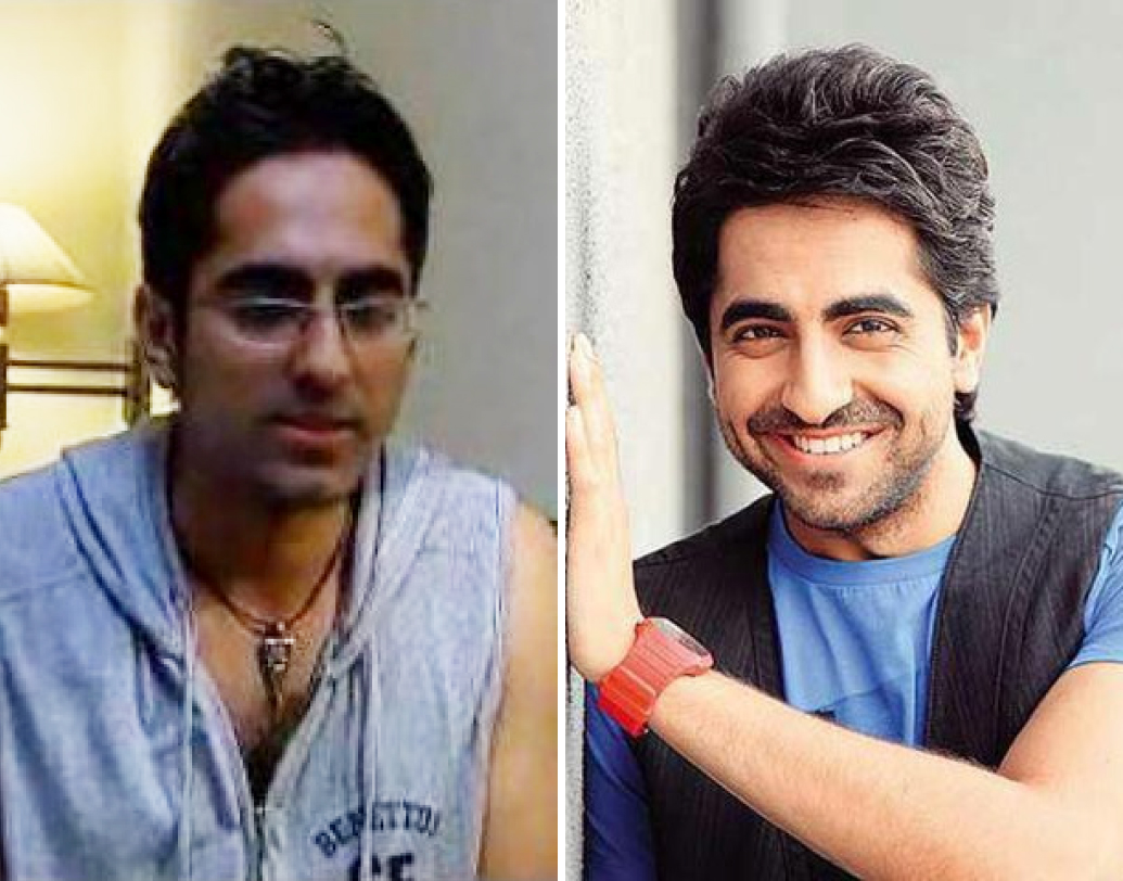 আয়ুষ্মান খুরানা: ‘ভিকি ডোনার’-কে সিনেমায় আসার আগে এক্কেবারে পাড়ার মোড়ের ছেলেটির মতোই দেখতে ছিল। গ্রুমিং আর নিয়মিত জিমের পর এখন এক্কেবারে আলাদা।