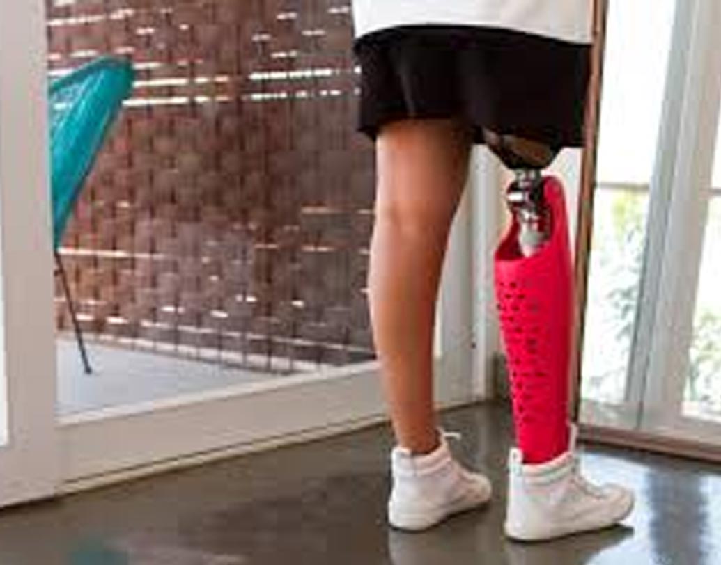 নিজের নকল পা (প্রোস্থেটিক) দিয়ে বিমান কর্মীকে মারধর করেন এক মদ্যপ মহিলা। ২০১৪ সালে এডিনবার্গ যাওয়ার পথে মাঝ আকাশেই ঘটে এই ঘটনা।