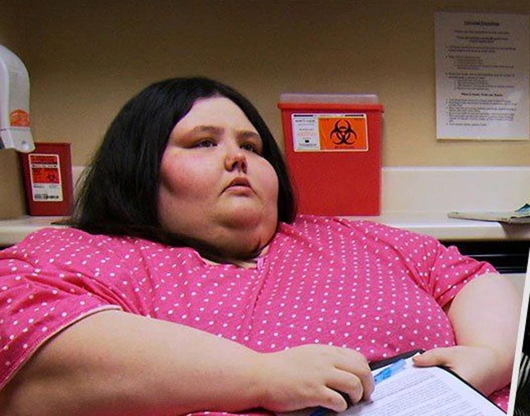 আট ফুট দূরত্ব পর্যন্ত এক টানা হাঁটতে পারতেন না ২৪ বছরের মার্কিন ক্রিশ্চিনা ফিলিপস। তখন তাঁর ওজন ছিল ৩২১ কিলোগ্রাম। ভেবেছিলেন বাঁচবেন না। সব কাজের উৎসাহ শেষ হয়ে গিয়েছিল ওজন বাড়তে বাড়তে।