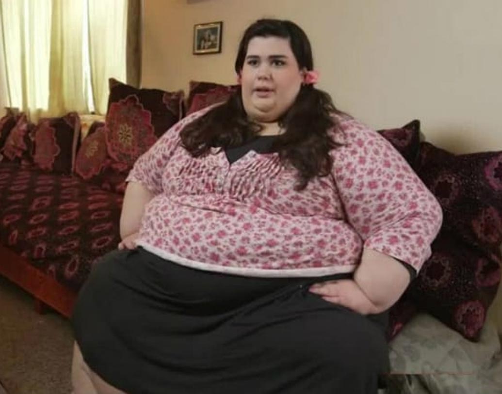 তিন বছর কঠোর ডায়েট আর পরিশ্রমের পর গ্যাস্ট্রিক বাইপাস সার্জারি। প্রায় ১৮২ কিলোগ্রাম ওজন কমিয়েছেন মার্কিন তরুণী অ্যাম্বার রাচডি।