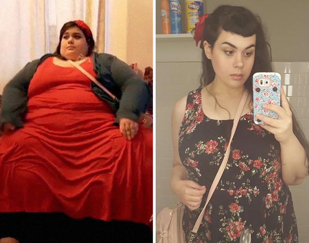 তিন বছর কঠোর ডায়েট আর পরিশ্রমের পর গ্যাস্ট্রিক বাইপাস সার্জারি। প্রায় ১৮২ কিলোগ্রাম ওজন কমিয়েছেন তিনি।