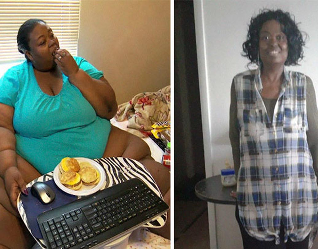 অস্ত্রোপচারের আগে কঠোর ডায়েট শুরু করেন মার্লা। ওজন দাঁড়ায় ২৪২ কিলোগ্রামে। এরপর অস্ত্রোপচার। ওজন হয় ১৩৬ কিলোগ্রাম। হাল ছাড়েননি তিনি। চলছে আরও ওজন কমানোর চেষ্টা। স্কিন রিমুভাল সার্জারিও করতে চান তিনি।