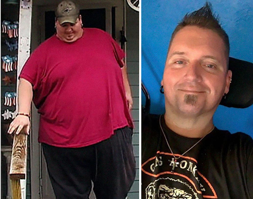 গ্যাস্ট্রিক বাইপাস সার্জারির পর তিনি যদিও অসু্স্থ হয়ে পড়েছিলেন। হুইলচেয়ারও ব্যবহার করতে হয়েছে। কিন্তু আশা ছাড়েননি। এখন তিনি রীতিমতো হ্যান্ডসাম হাঙ্ক।