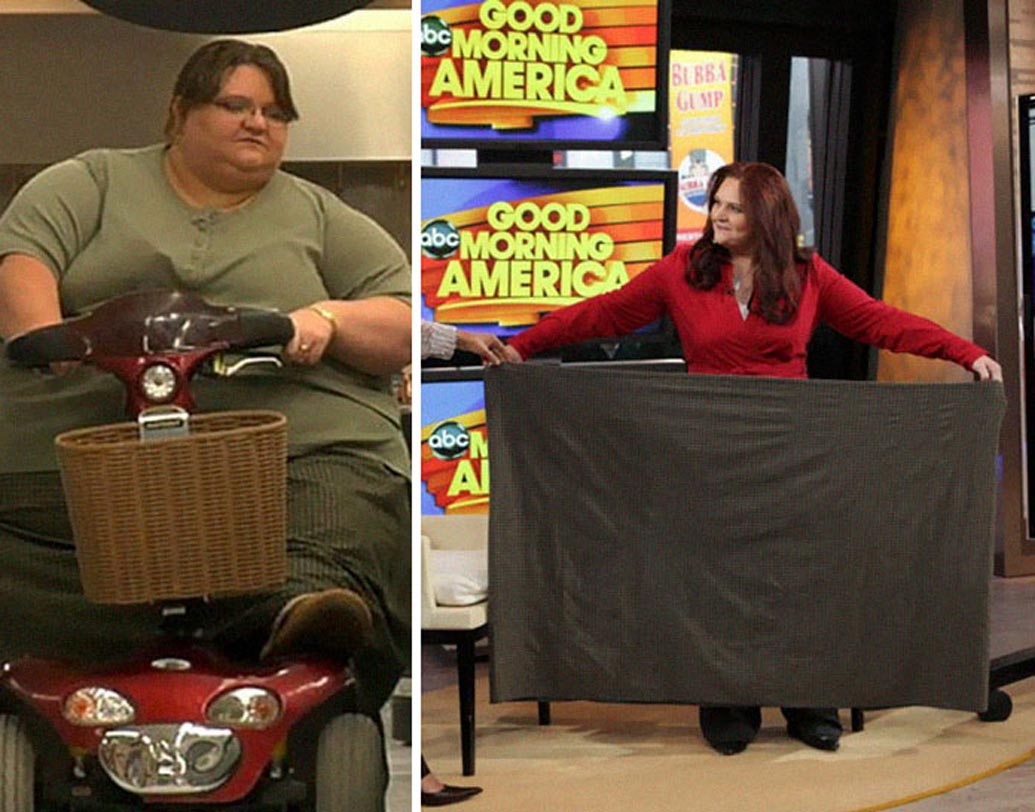 গ্যাস্ট্রিক সার্জারির পর ডাক্তারের চেম্বারে স্বেচ্ছাসেবী হিসাবে কাজ শুরু করেন মেলিসা। ডায়েটের কারণে রেফ্রিজারেটরের উপরেও ঝুলিয়ে রাখতেন নিষেধাজ্ঞা। ওজন কমার চার বছর পর জন্মায় তাঁর প্রথম সন্তান।