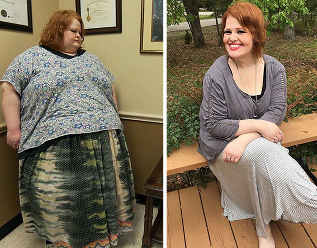 বছর চৌত্রিশের নিকি সবচেয়ে খুশি হন প্রথম জিনস কিনে। প্রথম ডেটিংও গিয়েছিলেন ওজন কমানোর পরে। স্কিন রিমুভাল সার্জারিও করেছেন তিনি।