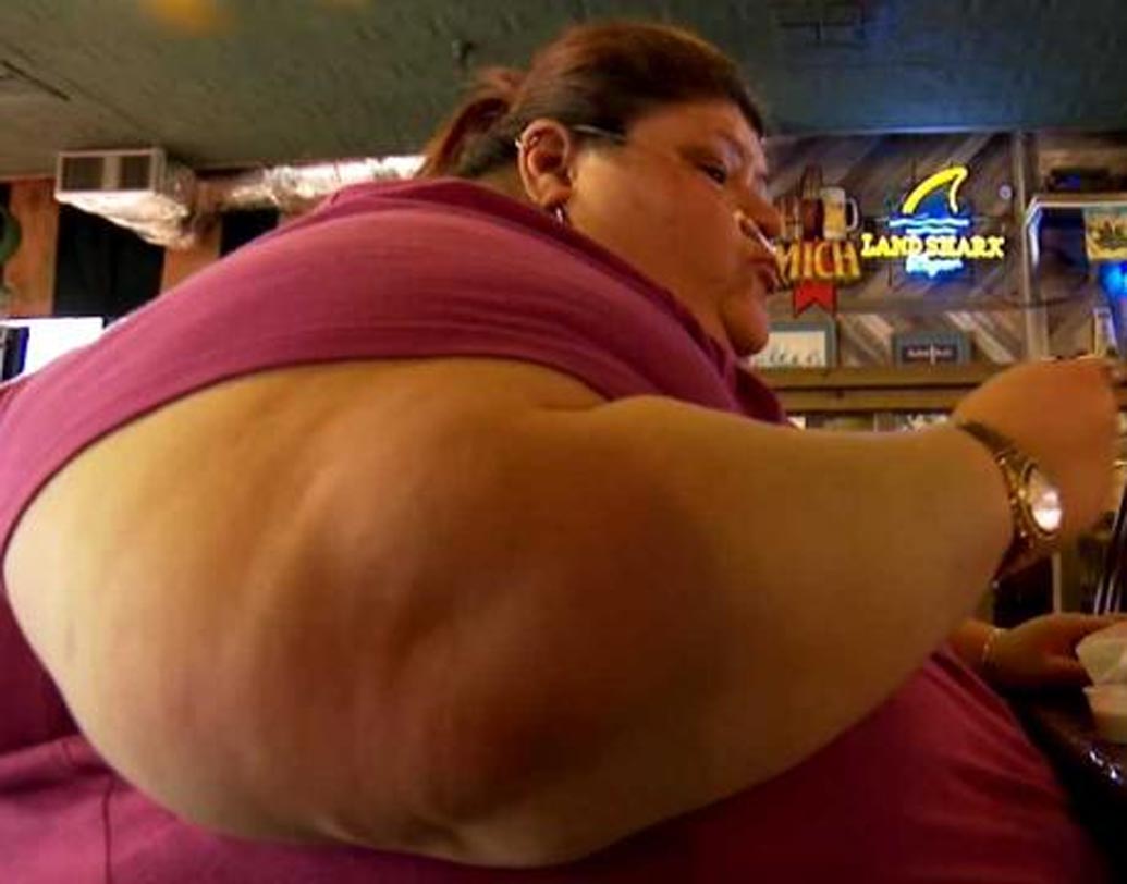 লরা পেরেজ অক্সিজেন ট্যাঙ্ক আর হুইলচেয়ার নিয়ে ঘুরতেন। বাকিদের মতো টেক্সাসের এক চিকিৎসকের কাছে গ্যাস্ট্রিক বাইপাস সার্জারি করান তিনিও।