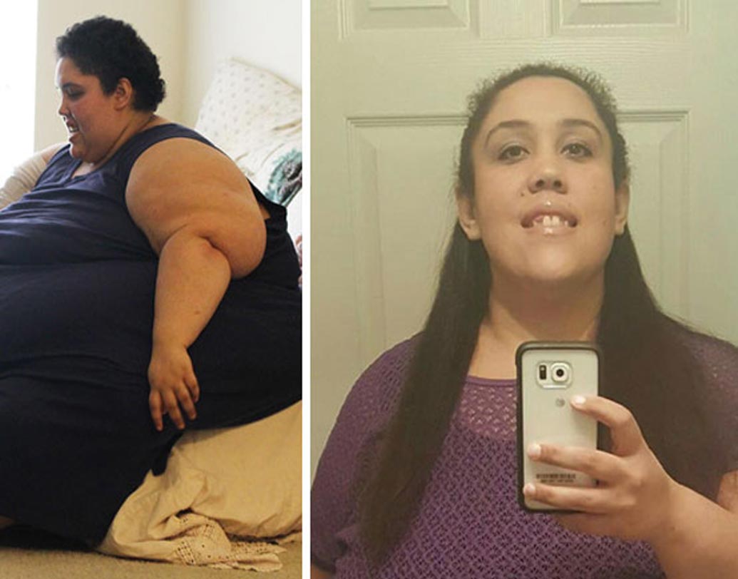 সুস্থ সন্তানের জন্ম দেওয়াটাও ছিল বিরাট ঝুঁকি। সাত মাসের গর্ভাবস্থায় দিনে মাত্র একবার বিছানা ছেড়ে উঠতে পারতেন তিনি। মেরুদণ্ডে তৈরি হয় অতিরিক্ত মাংসপিণ্ড। চিকিৎসকের পরামর্শ মেনে থাকায় সুস্থ ছেলের জন্ম দেন মার্কিন তরুণী জো। পরবর্তীতে ওজন কমেছে আরও বেশ খানিকটা।