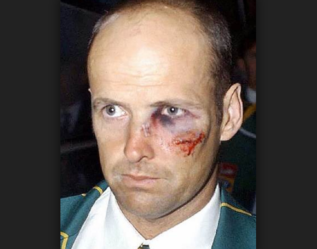 গ্যারি কার্স্টেন: ২০০৩-০৪ সাল। পাকিস্তানের শোয়েব আখতার তখন আগুন ছোটাচ্ছেন। প্রথম ইনিংসে ব্যাট করতে নেমে চোট পান কার্স্টেন। এক্স-রেতে দেখা যায় তাঁর নাকের হাড় ভেঙেছে। দ্বিতীয় ইনিংসে দলের স্কোর এক সময় ১৪৯ রানে চার উইকেট। সবাইকে অবাক করে ব্যাট করতে নামেন কার্স্টেন। এই অবস্থায় ৪০-এর উপর রান করেন তিনি।