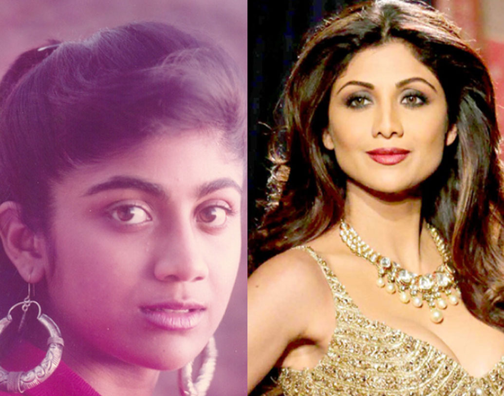 শিল্পা শেট্টি যে বলিউডের সবথেকে ফিট অভিনেত্রী, সে বিষয়ে কোনও সন্দেহ নেই। প্রায়শই সোশ্যাল মিডিয়ায় নিজের শরীরচর্চার ছবি পোস্ট করতে দেখা যায় অভিনেত্রীকে। দু’বার নাকের প্লাস্টিক সার্জারি করান অভিনেত্রী। আর তা নিয়ে সংবাদমাধ্যমের কাছে শিল্পার অকপট স্বীকারোক্তি, এমন কিছু বড় ব্যাপার নয় এটা।