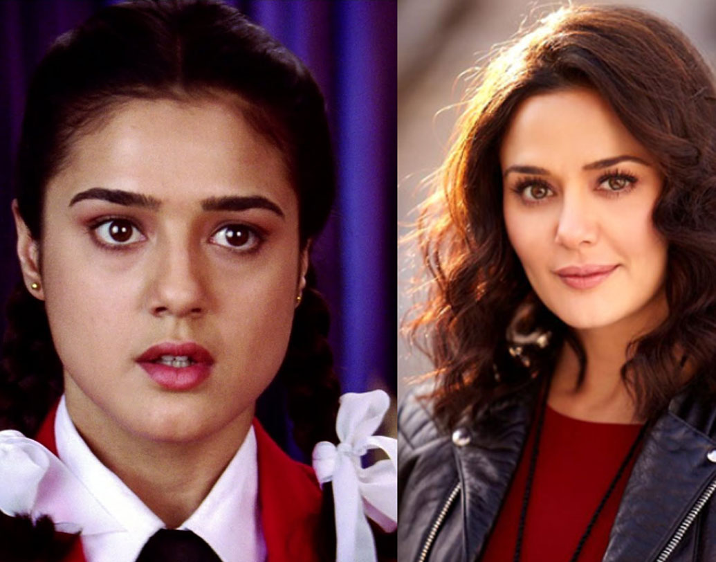 বোটক্স সার্জারি করেছিলেন অভিনেত্রী প্রীতি জিন্টাও। যদিও মিডিয়ার কাছে পুরোপুরি চেপে যান বিষয়টা। তবে অস্বীকার করলে কী হবে, ছবিই তো বলে দিচ্ছে যে, প্রীতি কসমেটিক্স সার্জারি করেছিলেন।