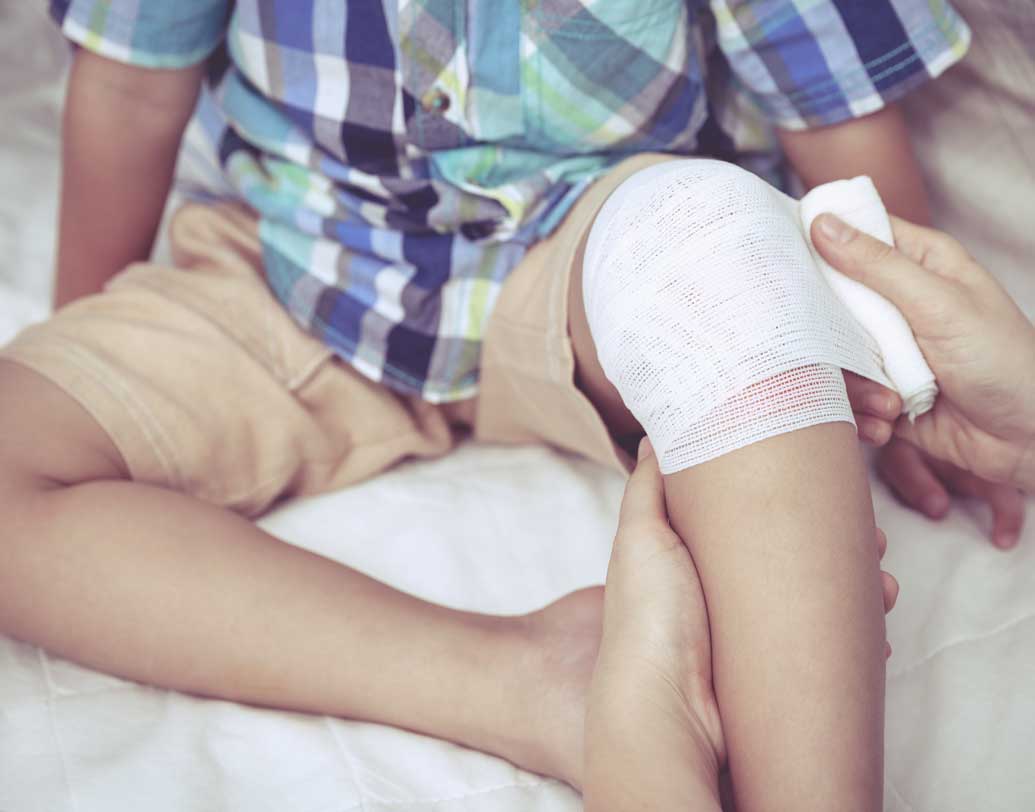 পড়ে যাওয়া: সদ্য হাঁটতে শেখা শিশু যখন-তখন আছাড় খায়। আবার প্রায়ই নানা ভাবেই পড়ে গিয়ে হাত-পা কেটে ফেলে ছোটরা। এ সবের জন্য বাড়িতে সব সময় মজুত রাখুন ব্যান্ডেজ, তুলো, গজ, অ্যান্টিসেপটিক লোশন ও ওষুধ। বাড়ির মেঝে বাধাহীন ও শুকনো রাখুন। সিঁড়িতে রেলিং রাখুন। মেঝে কার্পেট বা মাদুরে ঢেকে রাখুন। ছবি: শাটারস্টক।