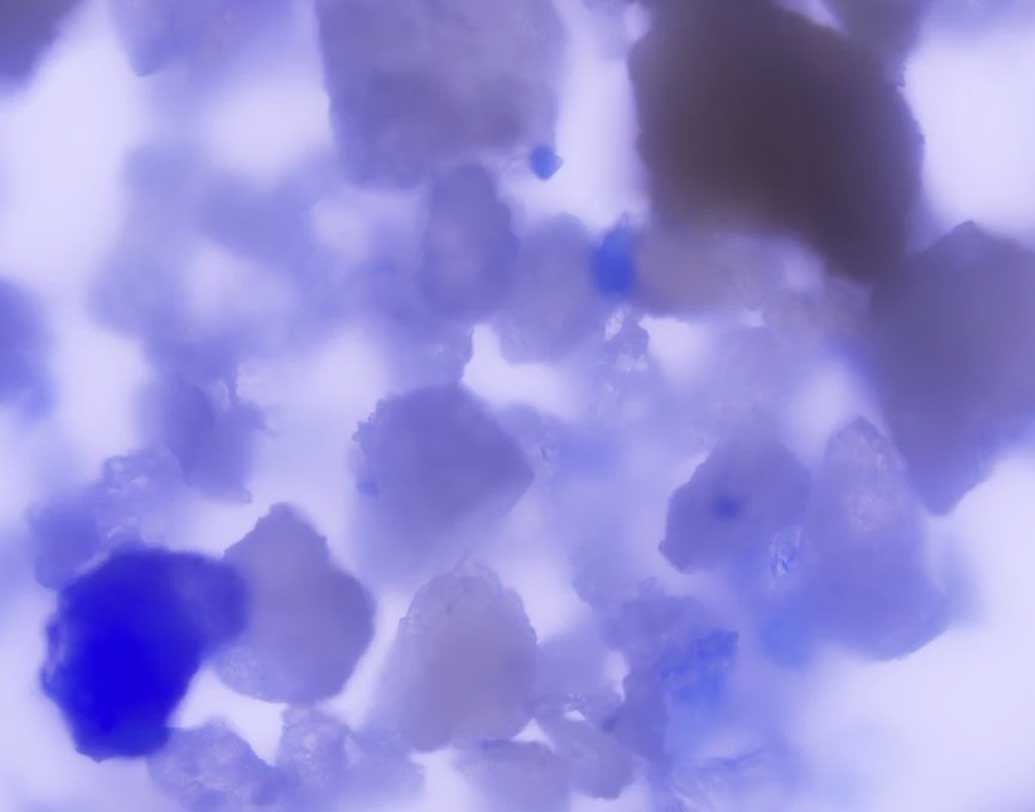 পবিত্র পাণ্ডুলিপি হোক বা আঁকা, মহিলা শিল্পী-লেখিকাদের নাম খুব কমই সেখানে লেখা থাকত। নাম থাকাকে মহিলাদের অসম্মান হিসাবে ধরা হত। এটা এই আবিষ্কার থেকে উঠে আসছে। কিন্তু মহিলা যে এক জন শিল্পীই ছিলেন, কী ভাবে নিশ্চিত হলেন গবেষকরা। বাইবেলে বা বইয়ে চুম্বন করার রেওয়াজ তো বহু দিনের। সেখানে থেকে কোনও ভাবে এই রং আসেনি তো?