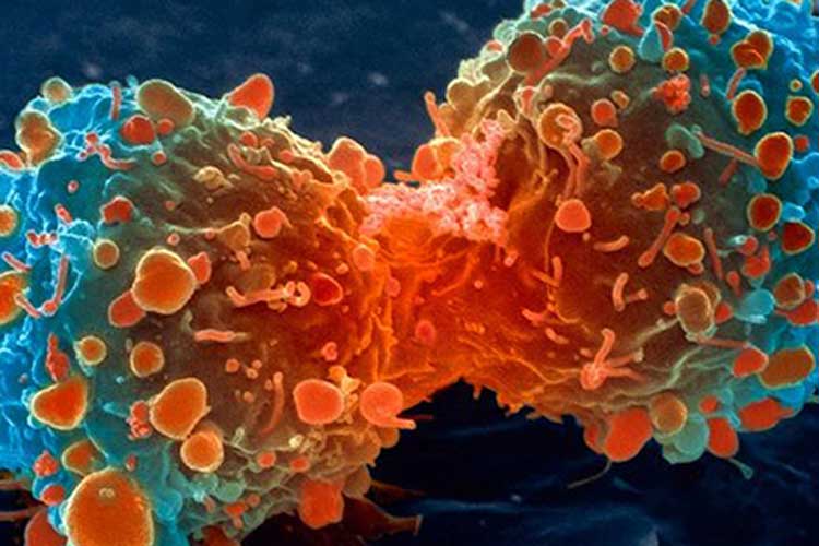 India to become 16th country to start with proton therapy in cancer treatment