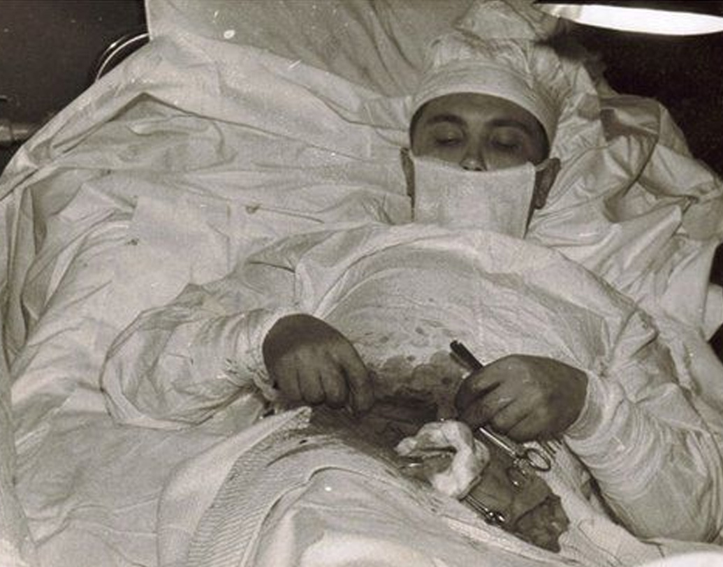 আধশোয়া রোগোজোভের সামনে ধরা হল আয়না। ইঞ্জেকশন দিয়ে তলপেটের নির্দিষ্ট অংশ অবশ করলেন তিনি। ডাক্তারি পরিভাষায় যাকে বলে লোকাল অ্যানাস্থেশিয়া। এরপর অস্ত্রোপচার শুরু করলেন তিনি।