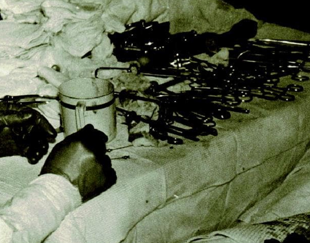 আয়নায় প্রতিবিম্ব দেখে এগোতে লাগল রোগোজোভের হাতের ছুরি-কাঁচি। অ্যাপেন্ডিক্স বাদ দিতে গিয়ে প্রথমে অন্য অঙ্গ ‘সিকাম’-কে আঘাত করে বসেন তিনি। তারপর সেটি সেলাই করে আবার নির্দিষ্ট দিকে এগোতে শুরু করল তাঁর হাতের অস্ত্র।