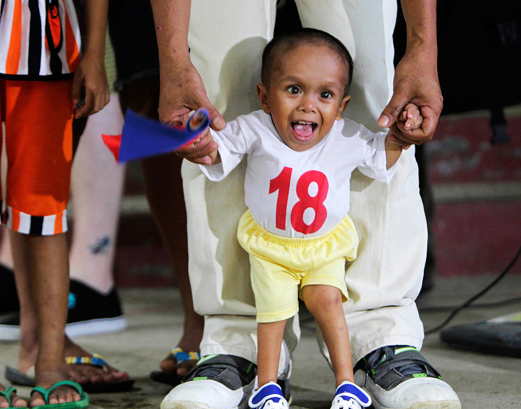 জুনরি বালাউইং: গিনেজ রেকর্ড অনুয়াযী বিশ্বের খর্বকায় ব্যক্তি জুনরি বালাউইং। উচ্চতা প্রায় ১ ফুট ১১.৬২ ইঞ্চি। ১৯৯৩-তে ফিলিপিন্সের সিন্দানগানে এক কামারের ঘরে জন্ম জুনরির। চার ভাইবোনের মধ্যে জুনরিই বয়সে বড়। এক বছর বয়স থেকেই তার শারীরিক বৃদ্ধি থমকে যায়।