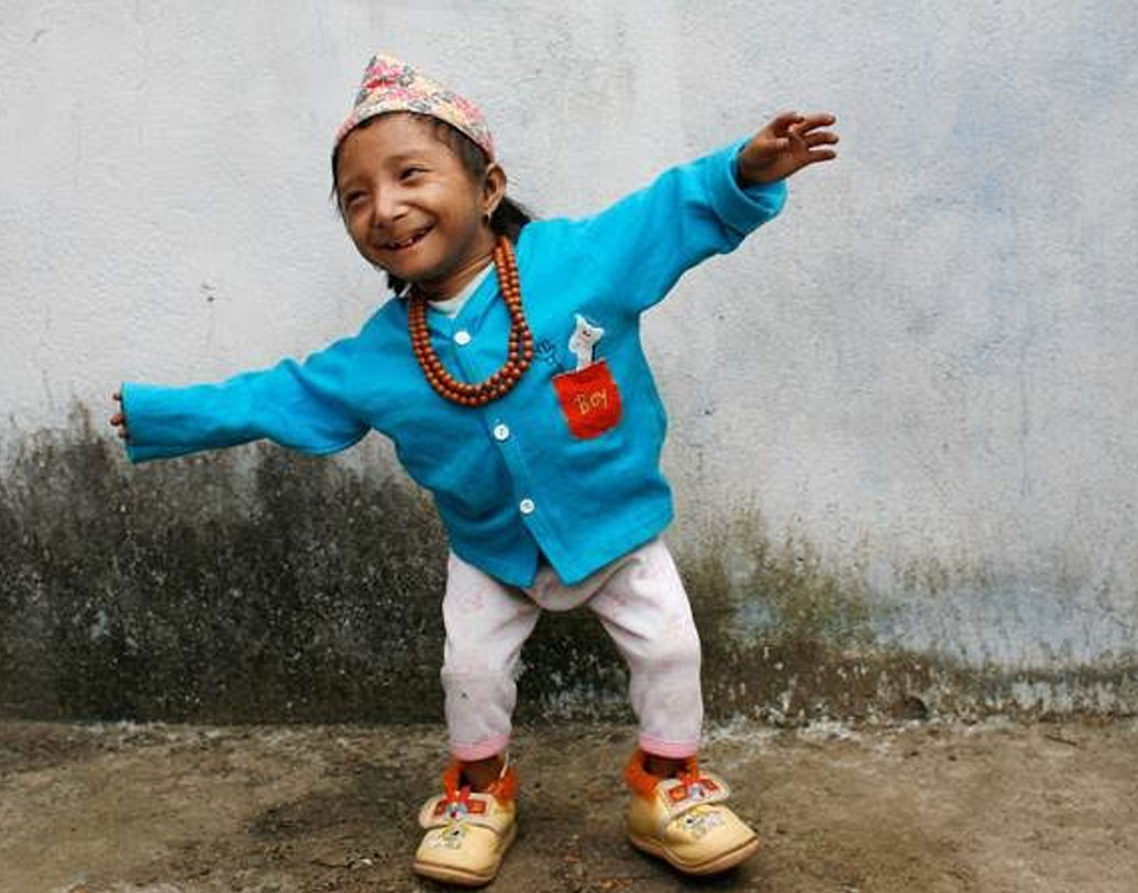 খগেন্দ্র থাপা: এডওয়ার্ড নিনো হার্নান্ডেজের পর বিশ্বের খর্বকায় পুরুষ হিসেবে রেকর্ড ছিল নেপালের বাসিন্দা খগেন্দ্রর। তাঁর উচ্চতা প্রায় ২ ফুট আড়াই ইঞ্চি। স্থানীয়দের কাছে তিনি ‘লিটল বুদ্ধ’ নামে পরিচিত।