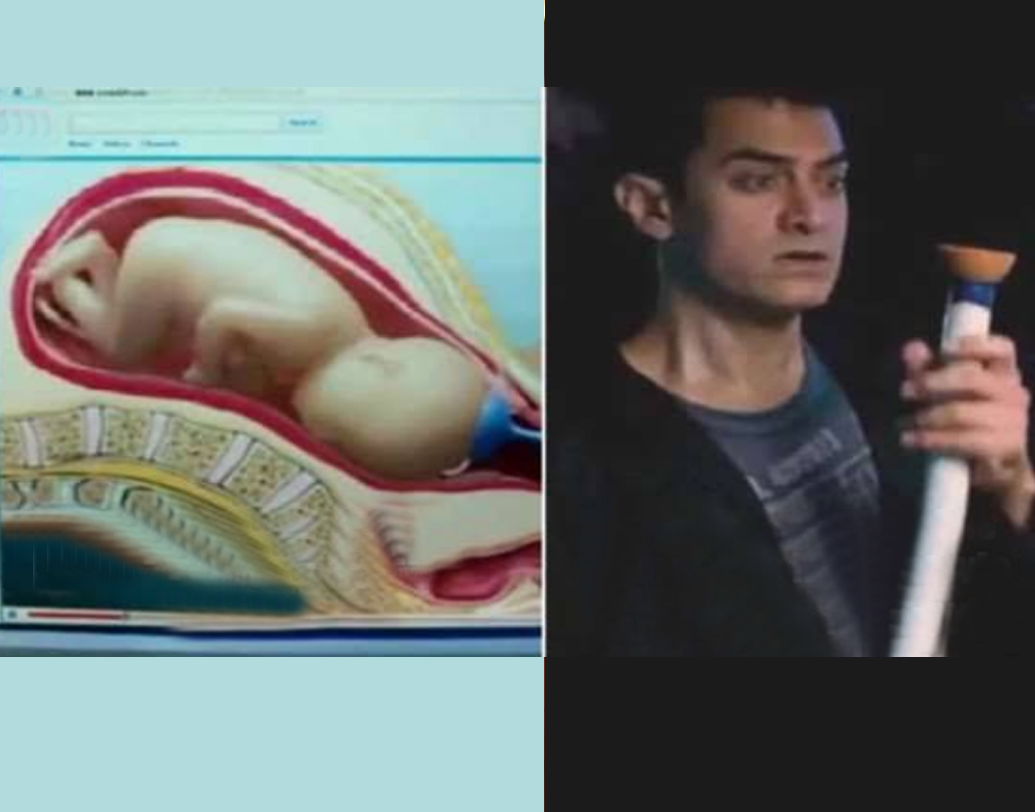 ‘থ্রি ইডিয়টস’-এর গল্পের পটভূমি ১৯৯৯ সাল। ভারতে ইউটিউব তখনও ভবিষ্যতের গর্ভে। অথচ রাঞ্চোরদাসরূপী আমির খান ইউটিউবে দেখে দেখে ভ্যাকুয়াম ক্লিনার দিয়ে মোনার সন্তান ভূমিষ্ঠ করিয়ে ফেলল!