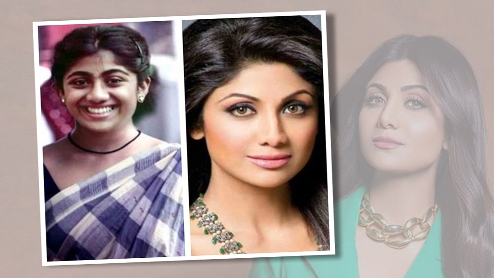 শিল্পা শেট্টি: নিজের নাকের আকার নিয়ে মোটেও খুশি ছিলেন না অভিনেত্রী শিল্পা শেট্টি। এখনও পর্যন্ত দু’ বার নোজ জব করিয়েছেন তিনি। তবে তা নিয়ে মোটেও লুকোছাপা করেননি শিল্পা। প্রকাশ্যে স্বীকারও করে নিয়েছেন। নেটিজেনদের মতে, আয়েষার মতো তাঁর ক্ষেত্রে প্লাস্টিক সার্জারি ‘ব্যাকফায়ার’ হয়ে দাঁড়ায়নি। বরং আখেরে লাভই হয়েছে। অভিনেত্রী নিজেও তাঁর বর্তমান লুক নিয়ে বেজায় খুশি।