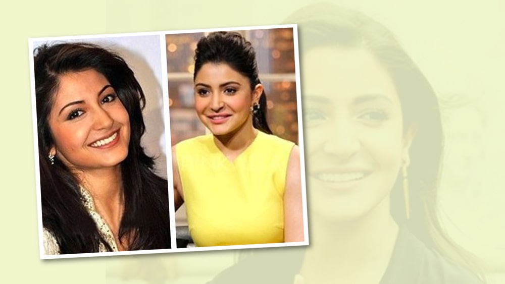 অনুষ্কা শর্মা: ‘লিপ জব’ শুনলেই প্রথমেই যে বলি অভিনেত্রীর কথা মাথায় আসে তিনি হলেন অনুষ্কা শর্মা। ‘পিকে’ ছবিতে অনুষ্কার ঠোঁট দেখে চমকে গিয়েছিলেন তাঁর ফ্যানেরা। অনুষ্কাও স্বীকার করে নিয়েছিলেন লিপ জব করিয়েছেন তিনি। তবে বিরাট পত্নীর দাবি ছিল, ছবির প্রয়োজনেই নাকি লিপ জব করিয়েছিলেন তিনি। পরে অবশ্য কোনও উপায়ে নিজের ঠোঁট আগের অবস্থায় ফিরিয়ে নিয়ে গিয়েছিলেন অভিনেত্রী। কী ভাবে? সে কথা শেয়ার করেননি কখনওই।