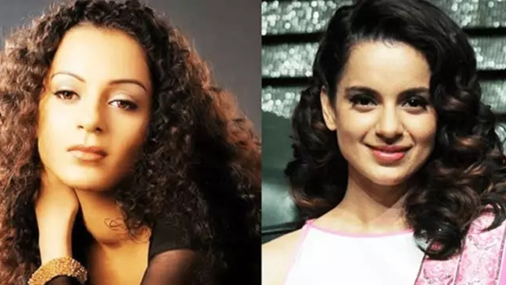 কঙ্গনা রানাউত: স্বয়ং বিগ-বি তাঁকে শ্রেষ্ঠ অভিনেত্রীর তকমা দিয়েছেন। ‘কুইন’, ‘কৃষ ৩’, ‘তনু ওয়েডস মনু’ নানা ছবিতে তাঁর অসামান্য অভিনয় অচিরেই তাঁকে প্রথম সারির অভিনেত্রীর দলে জায়গা করে দিয়েছে। কিন্তু জানেন কি, ‘ঝাঁসি কি রানি... মণিকর্ণিকা’-ও করিয়েছিলেন প্লাস্টিক সার্জারি। গ্যাংস্টারের কঙ্গনা এবং কুইনের কঙ্গনাকে লক্ষ্য করলে পার্থক্যটা বুঝতে পারবেন আপনিও। বলি পাড়াতেও ফিসফাস, লিপ জব, নোজ জবের পাশাপাশি তিনি নাকি ব্রেস্ট ইমপ্ল্যান্টও করিয়েছিলেন।