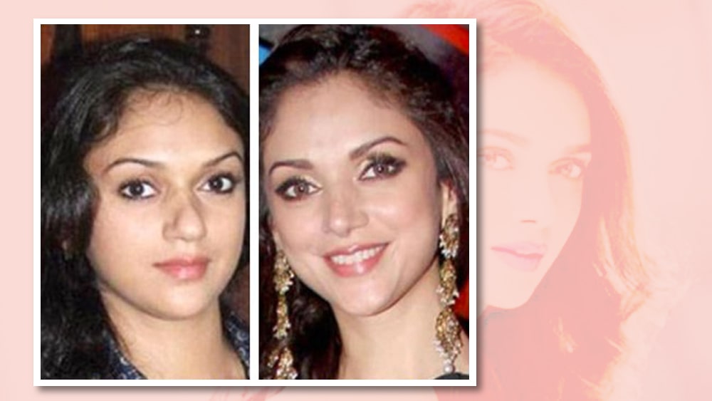 অদিতি রায় হায়দারি: নাক নিয়ে সন্তুষ্ট ছিলেন না অভিনেত্রী অদিতি রায় হায়দারি। টিকালো নাকের জন্য তিনিও করেছেন নোজ জব। শুধু তাকি নয়, শোনা যায় ‘পারফেক্ট জ লাইন’-এর জন্যও নাকি অস্ত্রোপচারের সাহায্য নিয়েছিলেন তিনি।