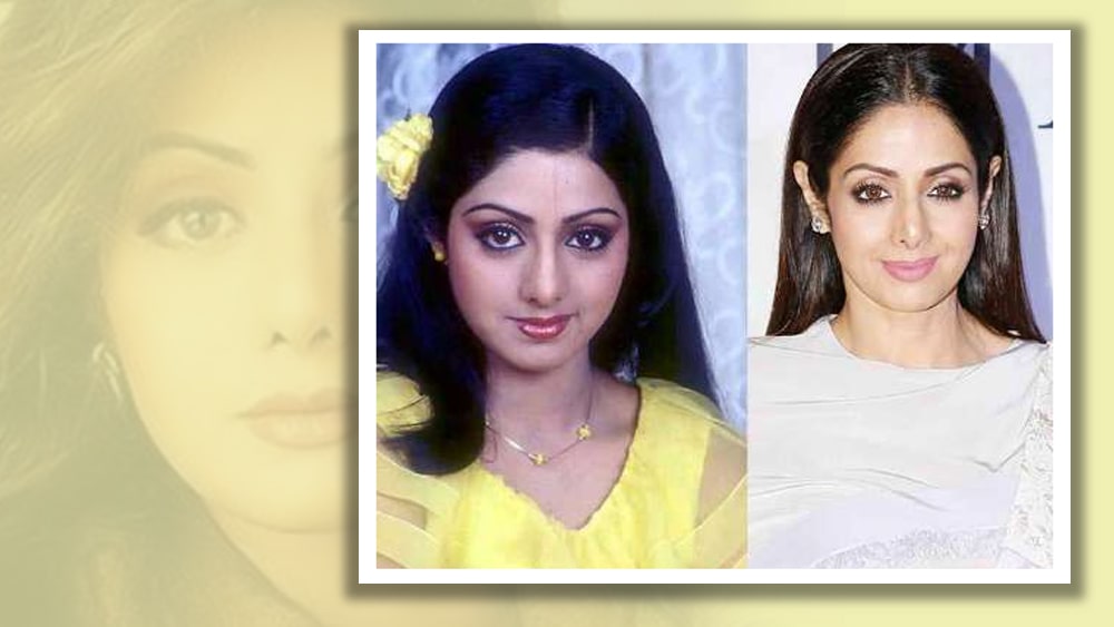 শ্রীদেবী: একাধিক বার কসমেটিক সার্জারি করেছিলেন শ্রীদেবীও। তিনি মারা গেলে অনেকেই সেই প্লাস্টিক সার্জারিকেই মৃত্যুর কারণ হিসেবে দায়ী করেছিলেন।