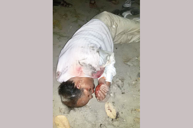 Lok Sabha Election 2019: BJP leaders injured by the attack of goons