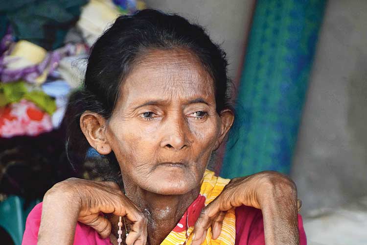 Severe water problem at Balurghat village