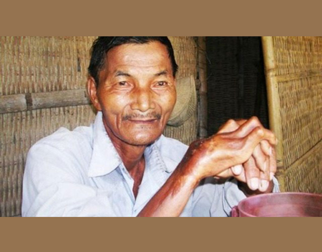 তাই এনগকের নাম বোধহয় অনেকেই শোনেননি। ৪৬ বছর ধরে না-ঘুমিয়ে কাটিয়েছেন এনগক। ভিয়েতনামের ৭৭ বছরের এই বৃদ্ধ নাকি ১৯৭৩-র পর থেকে আর ঘুমোননি। এমনটা দাবি সে দেশের সংবাদ সংস্থা তানহ নিয়েন-এর। তবে এত বছর ধরে দু’চোখের পাতা এক না করলেও দিব্যি সুস্থ রয়েছেন এনগক।