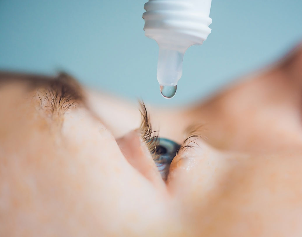 চোখ লাল হয়েছে বা একটু কড়কড় করছে? ওমনি ওষুধের দোকানে বলে কিনে ফেললেন ড্রপ, কিংবা বাজারচলতি প্রচলিত ড্রপ লাগিয়ে নিলেন চোখে। এই অভ্যাস থাকলে আজই তা বদলান। চিকিৎসকের পরামর্শ ছাড়া ড্রপ লাগালে তার পার্শ্বপ্রতিক্রিয়া কী হতে পারে, বা আপনার চোখে তা কী ধরনের প্রভাব ফেলতে পারে, সে সিদ্ধান্ত চিকিৎসককেই নিতে দিন।