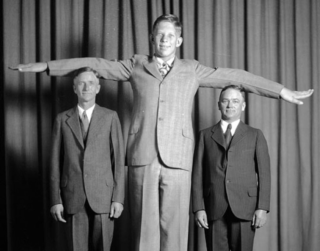 কিন্তু আর পাঁচটা শিশুর মতো স্বাভাবিক বৃদ্ধি হয়নি রবার্টের। এক বছর বয়সে তাঁর উচ্চতা গিয়ে ঠেকে ৩ ফুট সাড়ে ৩ ইঞ্চিতে। ওজন বেড়ে দাঁড়ায় ২০ কেজি ৪০ গ্রামে।