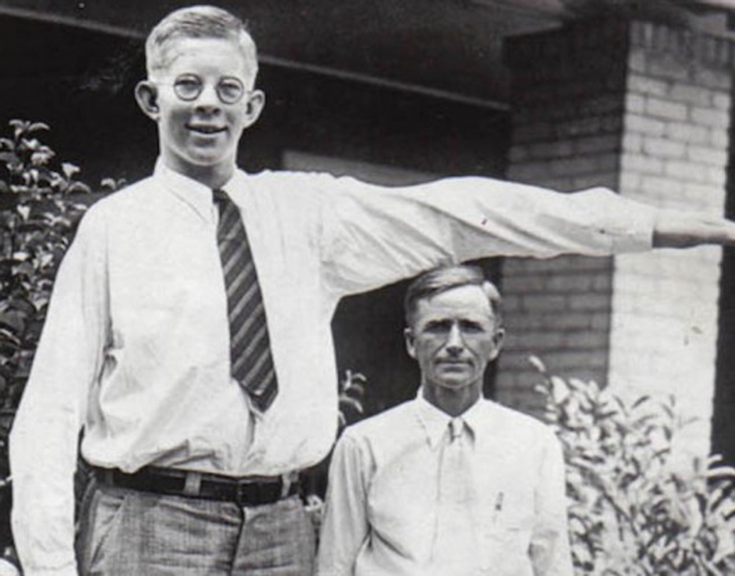 মাত্র ৮ বছর বয়সে উচ্চতায় বাবা হ্যারল্ড ফ্র্যাঙ্কলিনকেও ছাড়িয়ে যান তিনি। সেই সময় তাঁর উচ্চতা ছিল ৫ ফুট ১১ ইঞ্চি। উচ্চতার জন্য স্কুলে রবার্টের বসার উপযোগী আলাদা চেয়ার তৈরি করা হয়।