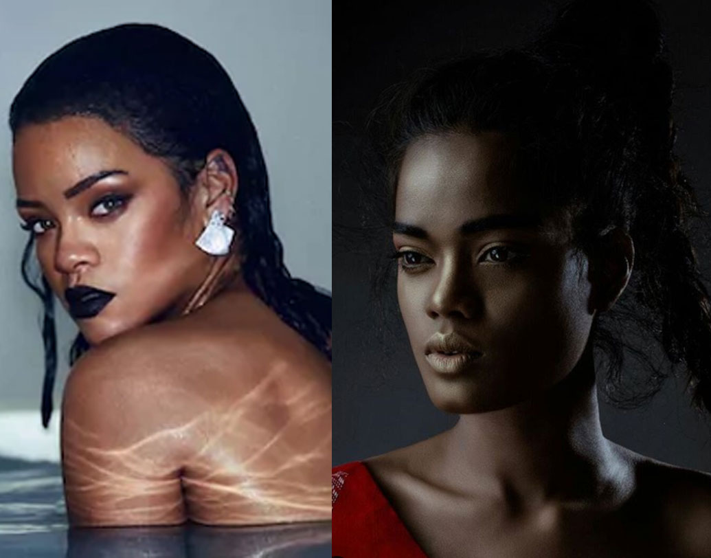 নানা বাধা কাটিয়ে ফ্যাশন মডেল হিসাবে নিজেকে খ্যাতির শীর্ষে নিয়ে গিয়েছেন রেনে। তবে যাঁর সঙ্গে তাঁর চেহারার এত মিল, সেই রিহানা (ছবিতে বাঁ-দিকে)-র সঙ্গে এখনও পর্যন্ত দেখা হয়নি। এক দিন তাঁর সঙ্গে দেখা করতে চান তিনি। তাঁর কথায়, ‘‘রিহানার সঙ্গে দেখা করে ওঁকে ধন্যবাদ দিতে চাই।’’