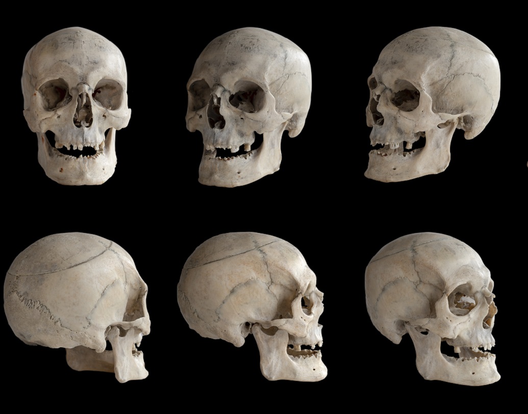 কিন্তু সঠিক কী হয়েছিল, সেই রহস্যের সমাধান করা যাচ্ছিল না। কয়েক বছর আগে আধুনিক প্রযুক্তি ব্যবহার করে এই রহস্যের সমধান করা সম্ভব হয়েছে।