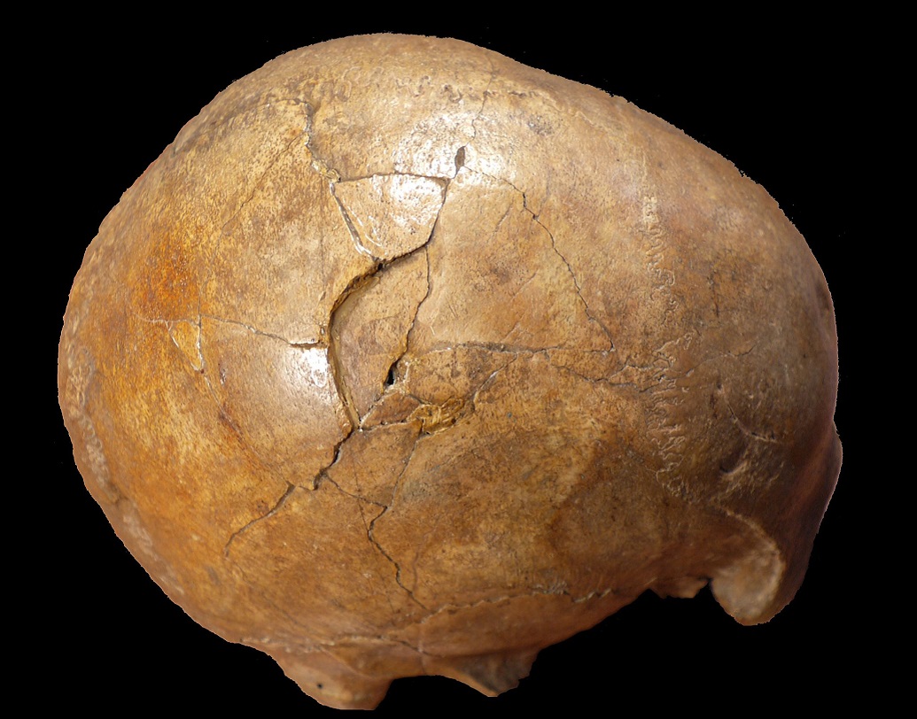 এই খুলিতে ছিল দু’টি আঘাতের চিহ্ন। মাথার সামনে দু’টি ছোট আঘাত এবং মাথার পিছনে একটি গভীর আঘাত।