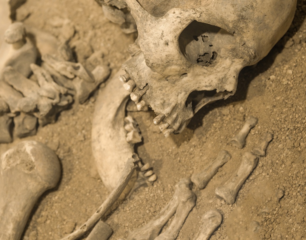 বিজ্ঞানীরা মনে করছেন, যে ভাবে তাঁর মাথায় আঘাত করা হয়েছে, তার থেকে স্পষ্ট যে, তাঁর শরীরেও আঘাত থাকতে পারে।