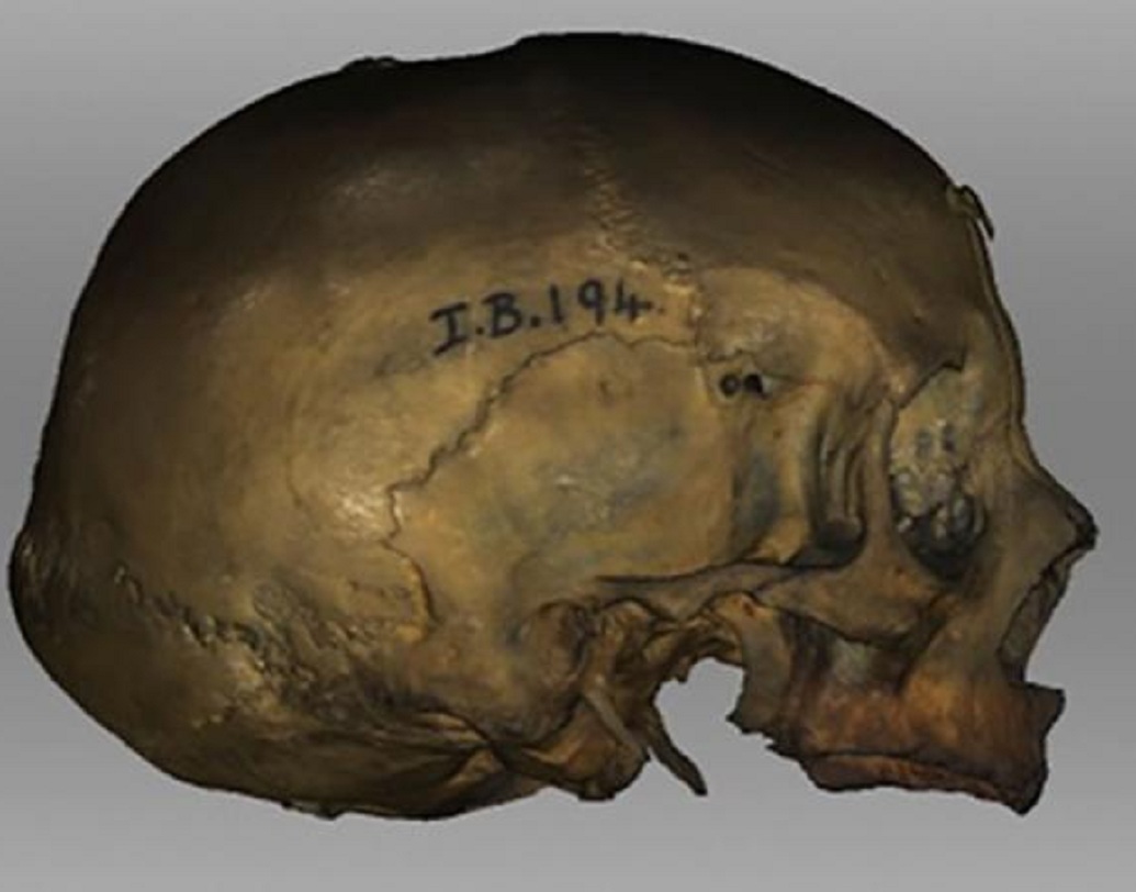 যে মহিলার মুখাবয়ব গড়ে সাড়া ফেলে দিয়েছেন ক্যারেন, তিনিও ওই ড্রুয়িড গোষ্ঠীর ছিলেন বলে জানা গিয়েছে। তাঁর নাম ছিল হিলডা। তিনি ছিলেন বর্তমান স্কটিশ শহর স্টর্নোওয়ের বাসিন্দা। তিনিও সম্ভবত ছিলেন জাদুকরী।