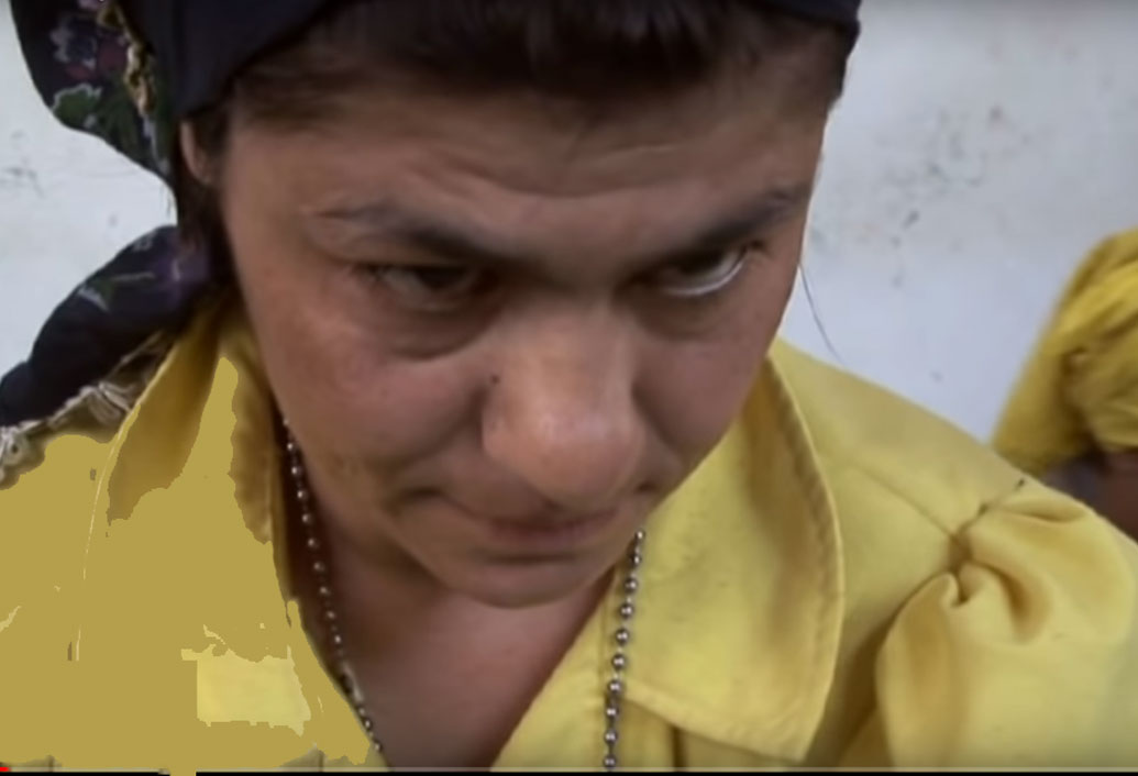 চারপেয়ে মানুষ! তারপর থেকে মাঝেমধ্যেই বিজ্ঞানীদের দল ঘুরে গিয়েছে তুর্কির ওই গ্রামে। রক্তের নমুনা, মস্তিষ্কের স্ক্যান, বাদ যায়নি কোনও পরীক্ষাই। কিন্তু ২০১৪ পর্যন্ত এমন ব্যবহারের সঠিক কোনও কারণ কেউ খুঁজে পাননি।