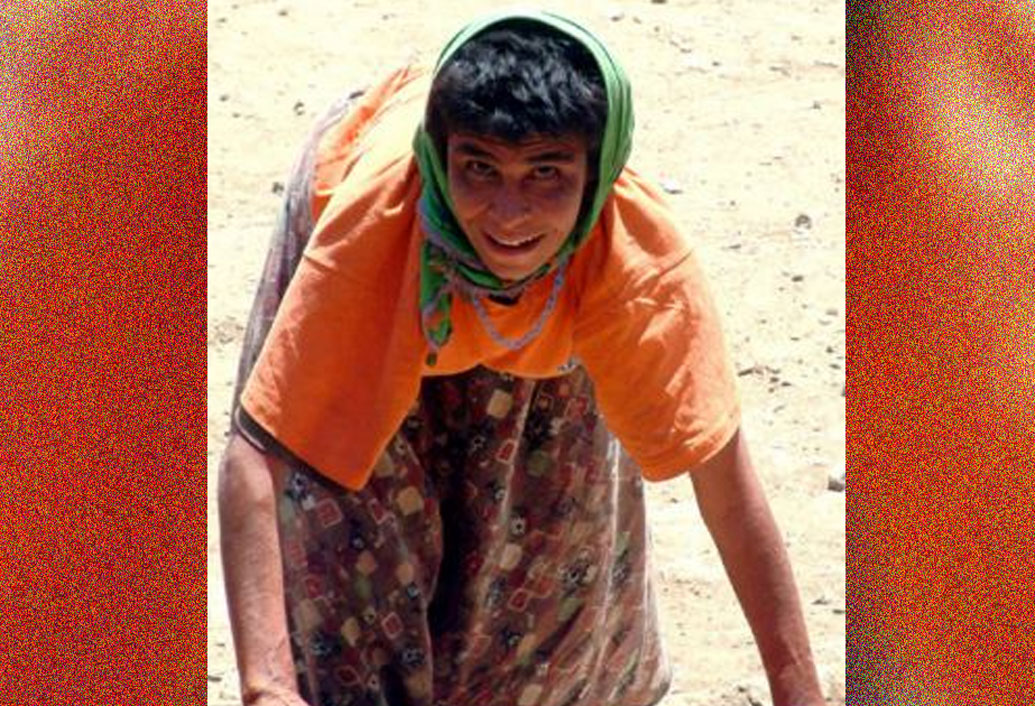 জানা যায়, বিপরীত বিবর্তন নয়, এটা আসলে জিন মিউটেশনের ফল। এটা অতি দুর্লভ একটা রোগ।