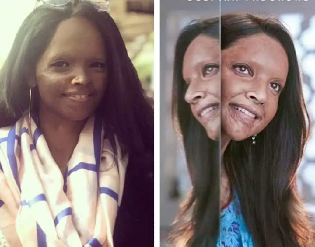 আগামী বছরের জানুয়ারিতে মুক্তি পেতে পারে ‘ছপক’। দর্শকদের মধ্যে ছবিটি নিয়ে যথেষ্ট আশা রয়েছে। অ্যাসিড আক্রান্ত লক্ষ্মী আগরওয়ালের ভূমিকায় দেখা যাবে দীপিকা পাড়ুকোনকে। ভবিষ্যতে এক জন আইনজীবী হবেন, এমনই স্বপ্ন তিলে তিলে গড়ে তুলছিলেন লক্ষ্মী। কিন্তু সেই স্বপ্ন পুড়ে যায় অ্যাসিডের ছোঁয়ায়। তাঁর উপর অ্যাসিড হামলা হয়।