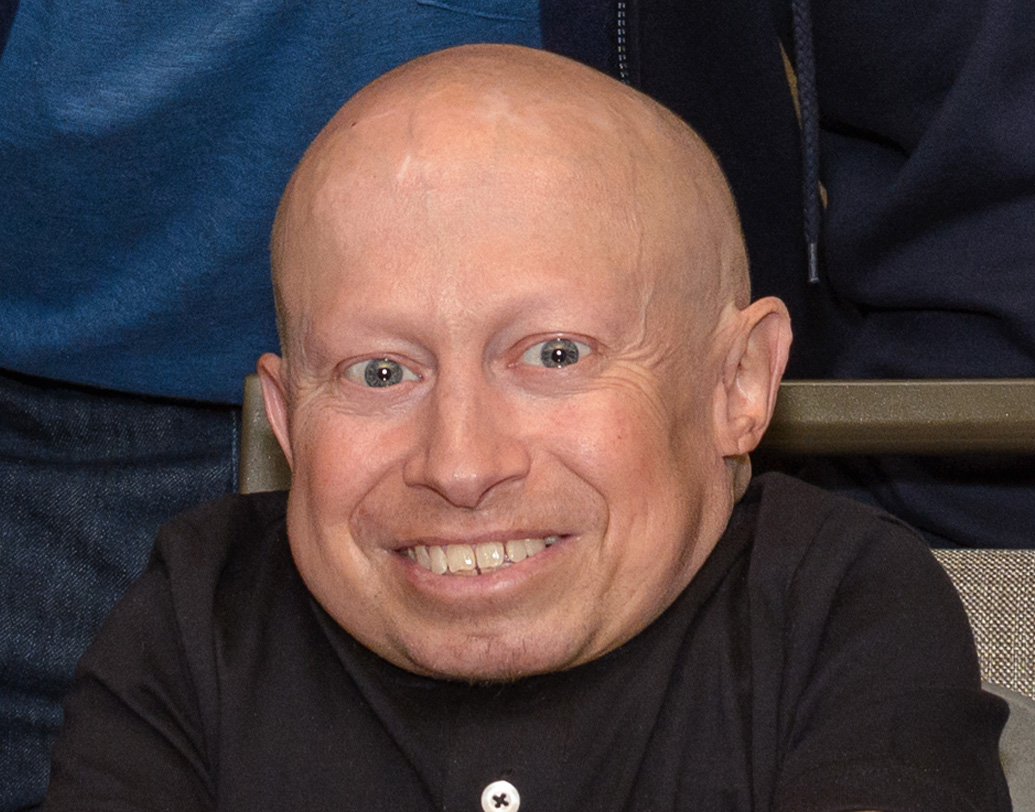 ‘বেবিজ ডে আউট’ নিয়ে আরও একটি চমকপ্রদ দিক হল বেবি বিঙ্ক-এর স্টান্ট ডাবল। বিশেষ বিশেষ দৃশ্যে শিশু অভিনেতার বদলে দুঃসাহসী স্টান্টের কাজ করেছিলেন স্টান্টম্যান ভার্ন ট্রয়ার।