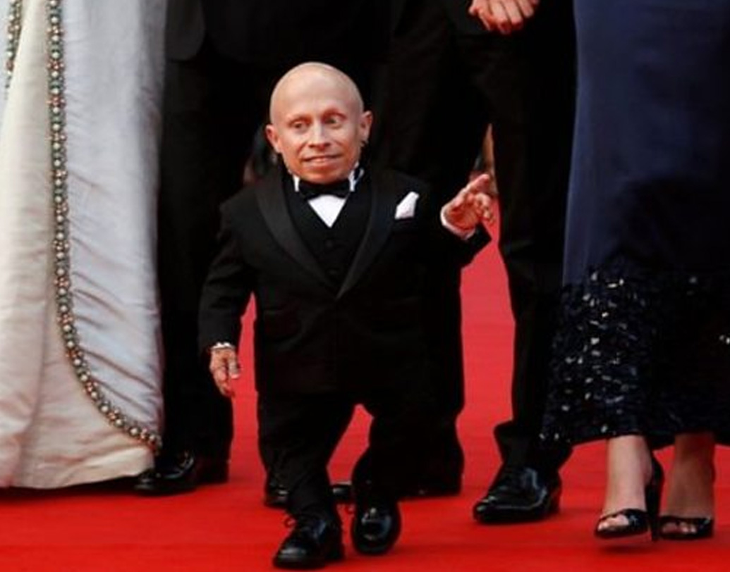 জটিল জিনগত অসুখ কার্টিলেজ-হেয়ার হাইপ্লোপেসিয়ায় আক্রান্ত ভার্নের উচ্চতা ছিল মাত্র ২ ফিট ৮ ইঞ্চি। তিনি ছিলেন বিশ্বের খর্বকায়তম মানুষের মধ্যে অন্যতম। ‘ডানস্টন চেকস ইন’, জিঙ্গল অল দ্য ওয়ে’, ‘মেন ইন ব্ল্যাক’ এবং ‘মাই জায়ান্ট’ ছবিতেও তিনি স্টান্ট ডাবলের কাজ করেছেন। দেখা গিয়েছে ছোটখাটো ভূমিকাতেও।