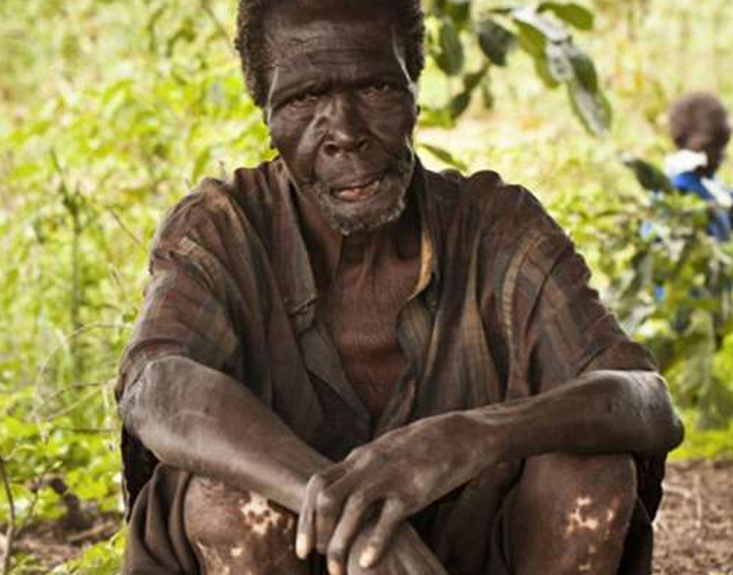 কেন ওই গ্রামের মানুষ দৃষ্টিশক্তি হারিয়ে ফেলছেন তা নিয়ে স্থানীয় প্রশাসন ও বিজ্ঞানীরা তদন্ত শুরু করে। লাবজুয়েলা গাছের যে গল্প গ্রাম জুড়ে ছড়িয়ে আছে তা নিয়েও তদন্ত করে তারা। কিন্তু দেখা যায়, ওই গাছের সঙ্গে এদের দৃষ্টিহীনতার কোনও সম্পর্কই নেই! তা হলে?  প্রতীকী ছবি।