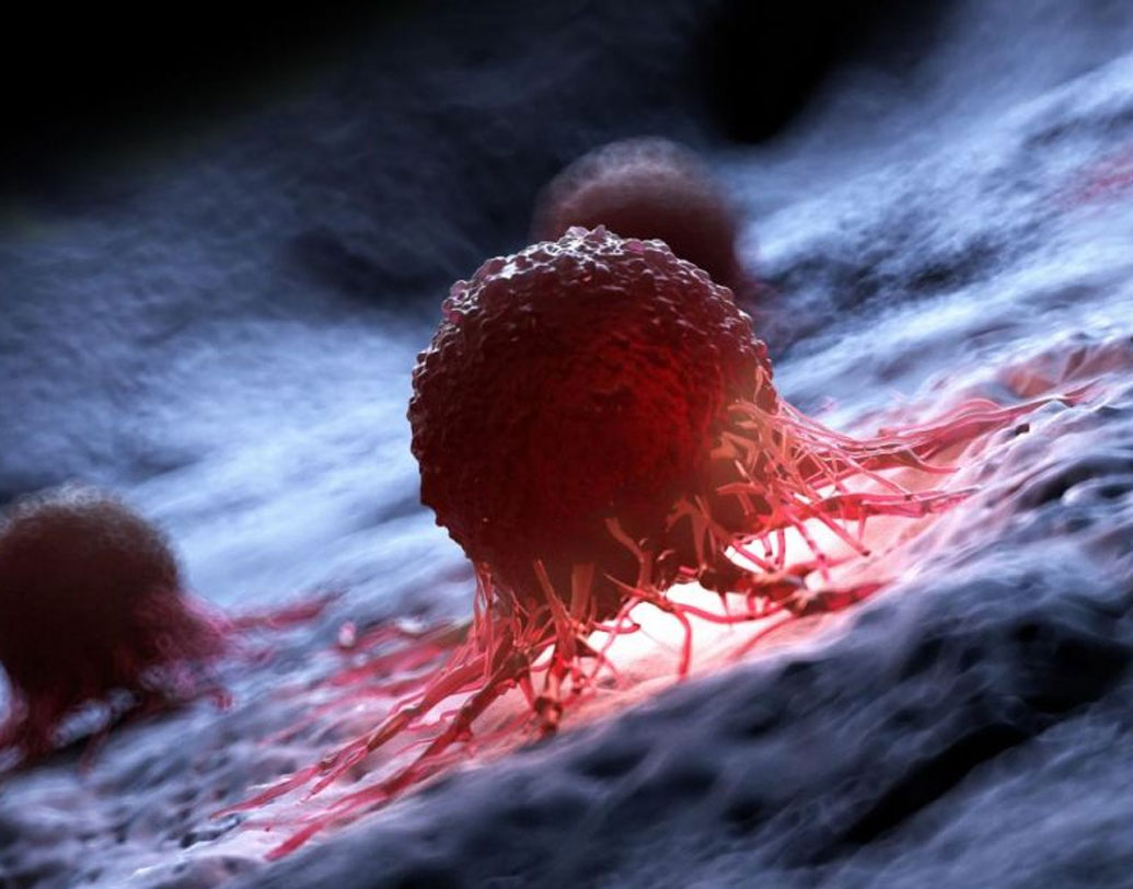 ক্যানসার হয়েছে জানলেই মানুষ আর্থিক এবং মানসিক ভাবে ভেঙে পড়েন। সেখানে নিম্ন মধ্যবিত্ত পরিবারের মেয়ে হয়েও যে ভাবে মনে জোরে বস্তির বাচ্চাদের মুখে খাবার তুলে দিচ্ছেন তিনি, সে জন্য কখনও হার না মানা আঁচলকে কুর্নিশ জানিয়েছেন তাঁর চিকিৎসকেরাও। যে হাসপাতালে তাঁর চিকিৎসা চলছে, সেখান থেকে তাঁকে সম্মানিত করা হয়েছে।