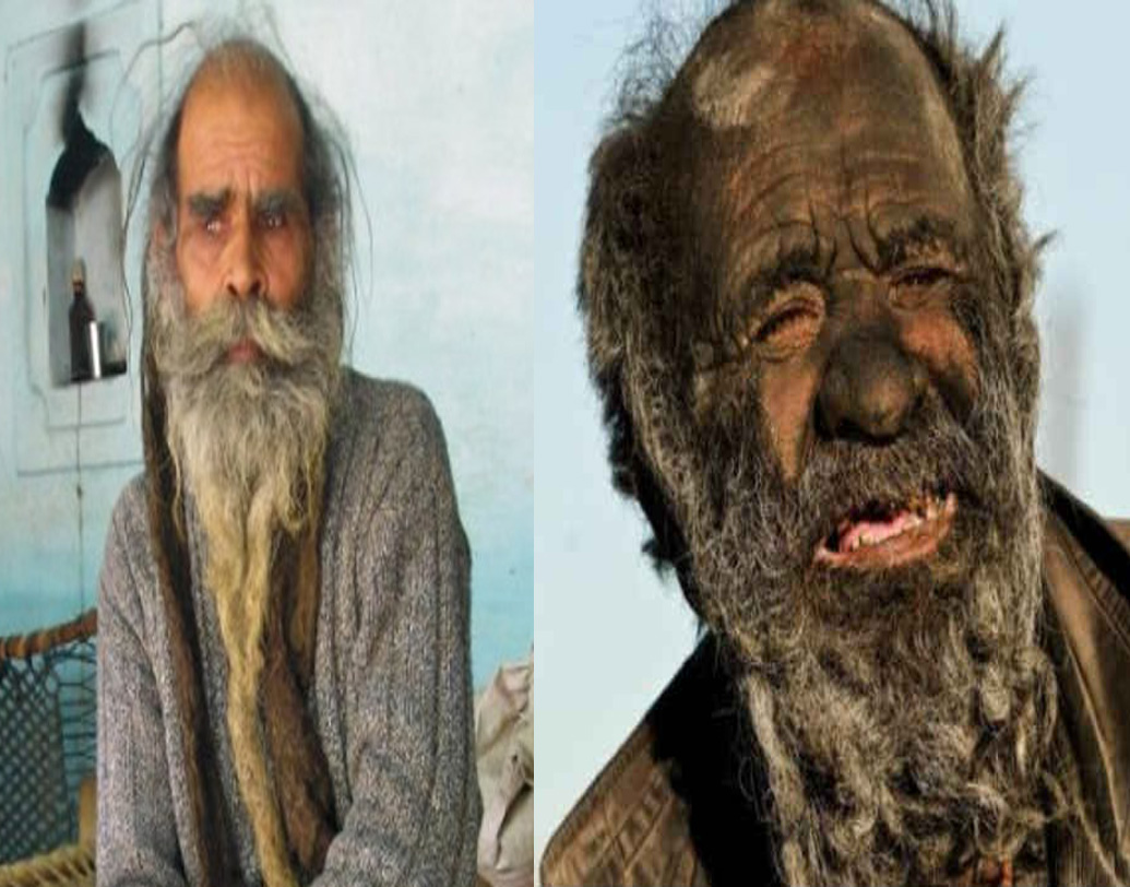 কৈলাস বলেছেন, একমাত্র পুত্রসন্তানই তাঁকে পারবে স্নান করাতে। এ জন্মে হবে না। পরজন্মে পুত্রসন্তানের পিতা হয়ে স্নান করবেন তিনি। কৈলাস তাও স্নান করার শর্ত দিয়েছেন। কিন্তু ইরানের আমৌ হাজি সে পথেও হাঁটেননি। স্নান না করেই পৃথিবীর দুই প্রান্তে দিব্য়ি আছেন এই দুই পুরুষ।  (ছবি: সোশ্যাল মিডিয়া)