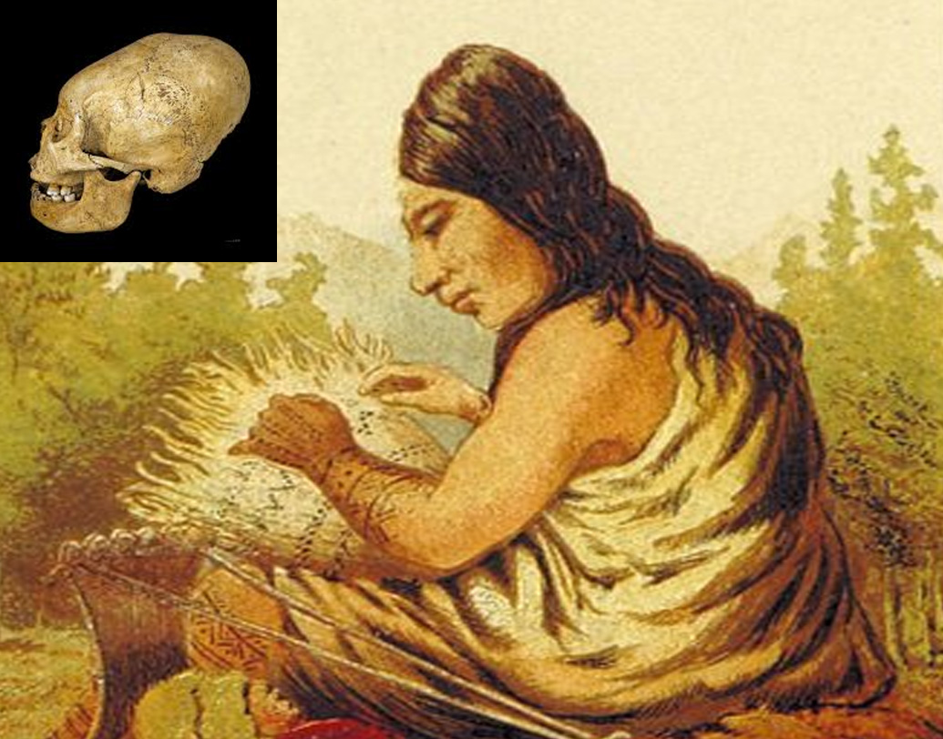 আর্টিফিশিয়াল ক্র্যানিয়াল ডিফর্মেশন বা এসিডি হল শিশুর মাথা শক্ত করে বেঁধে রাখা। যাতে তার করোটির গঠন বিকৃত হয়। বডি মডিফিকেশনের এই রীতি পৃথিবী জুড়ে চলে আসছে নব্য প্রস্তর যুগ থেকে। ইউরোপে কৃষ্ণসাগরের কাছাকাছি দেশগুলোয় এই রীতি শুরু হয়েছিল দ্বিতীয় ও তৃতীয় শতকে। চূড়ান্ত পর্যায়ে উঠেছিল পঞ্চম ও ষষ্ঠ শতকে। সপ্তম শতকে অবলুপ্ত হয়ে যায়।